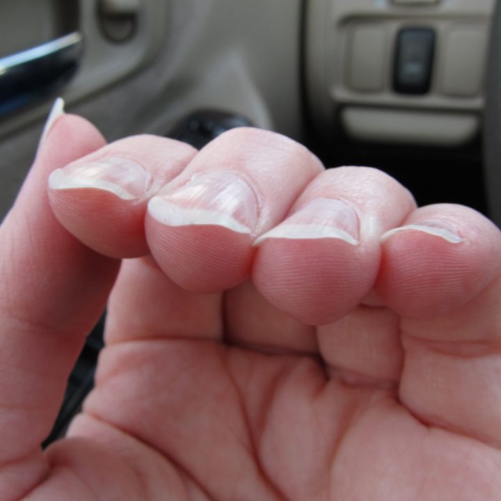 Как ухаживать за тонкими и ломкими ногтями?